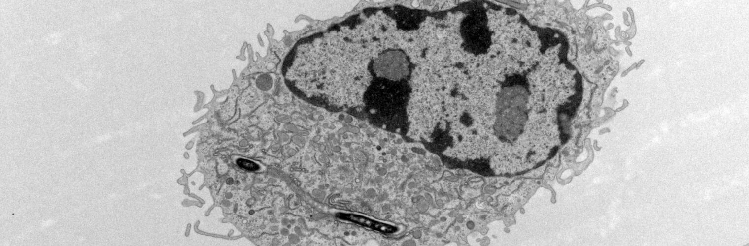Macrophage infected with Legionella bacteria
