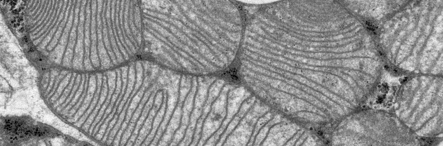 Mitochondria from high pressure frozen brown adipose tissue