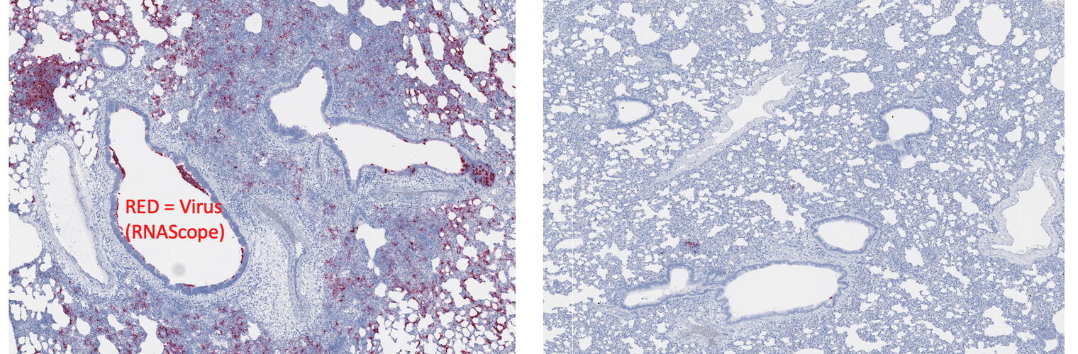Hamster lung w-wo COVID vaccine