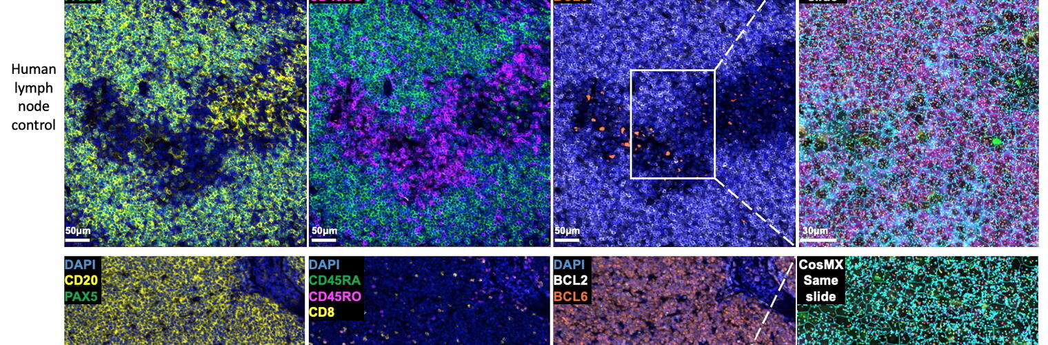 IN-Depth DLBCL image 1