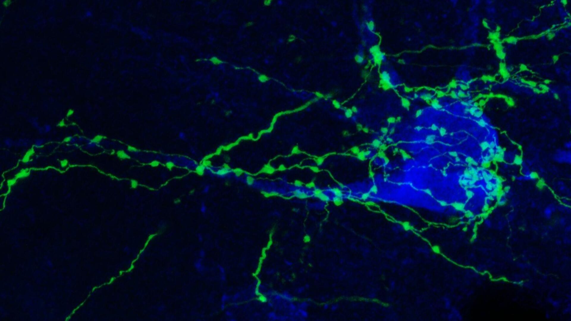 green-fibers-wrapped-around-blue-neuron
