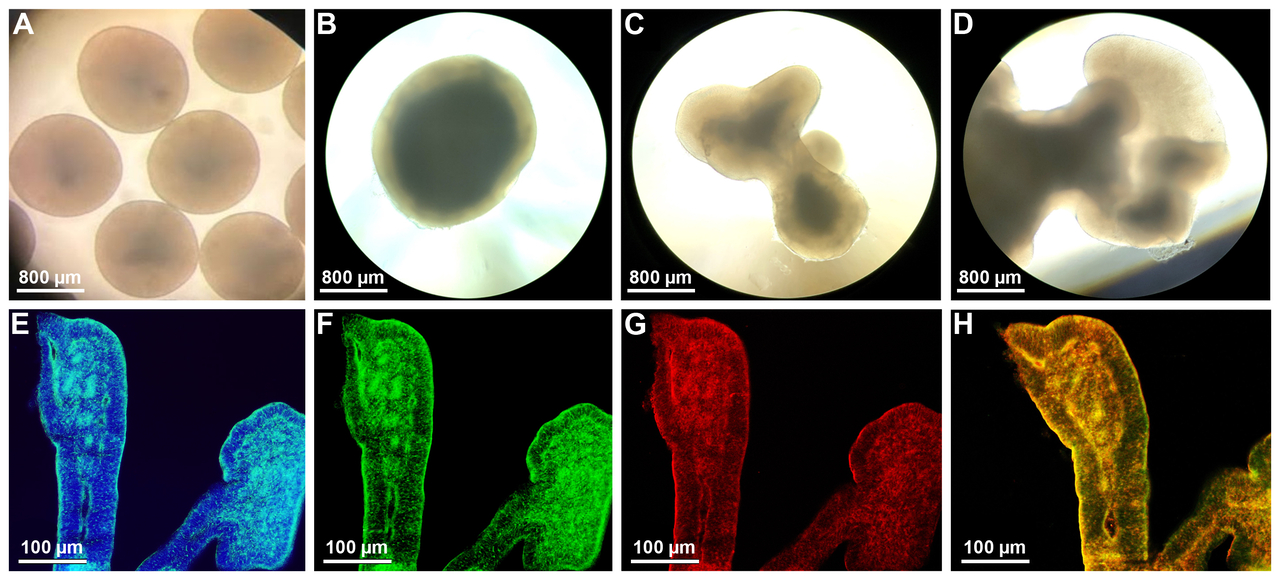 Immunofluorescence of brain organiods