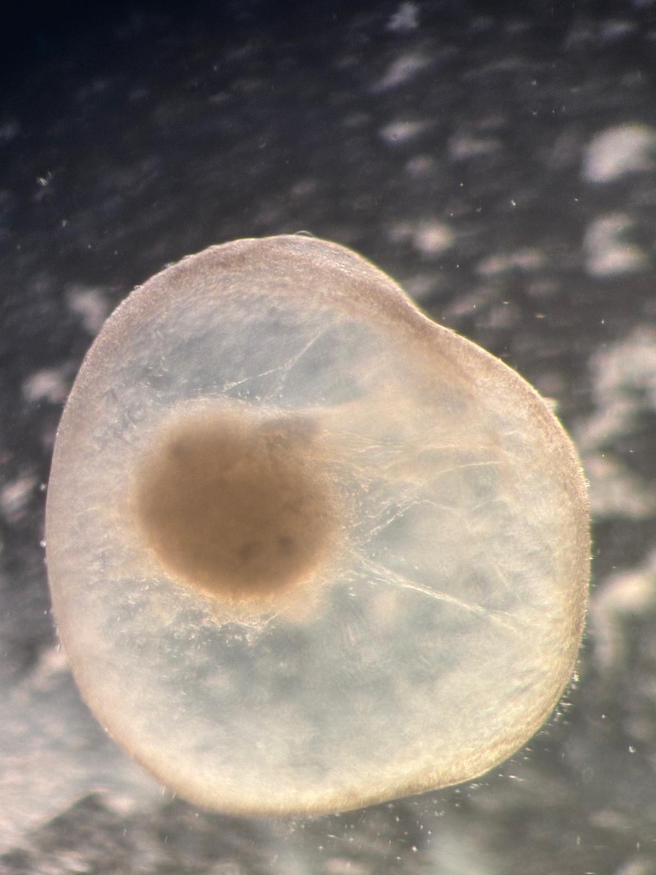 organoid
