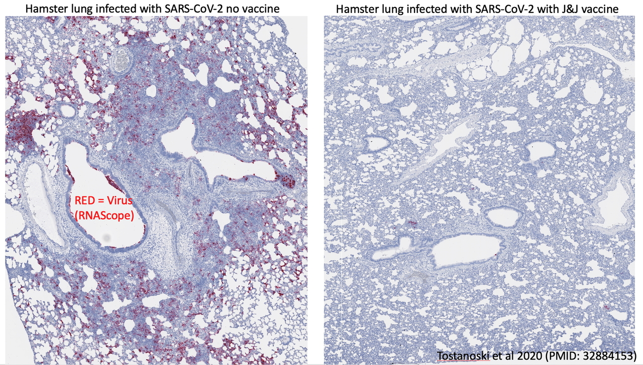 Hamster lung w-wo COVID vaccine
