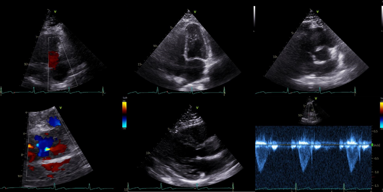 Series of cardiac echos