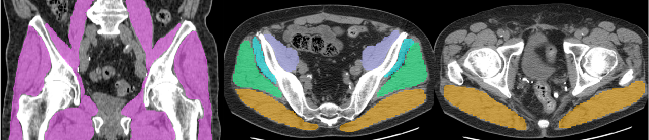 Hip Muscle