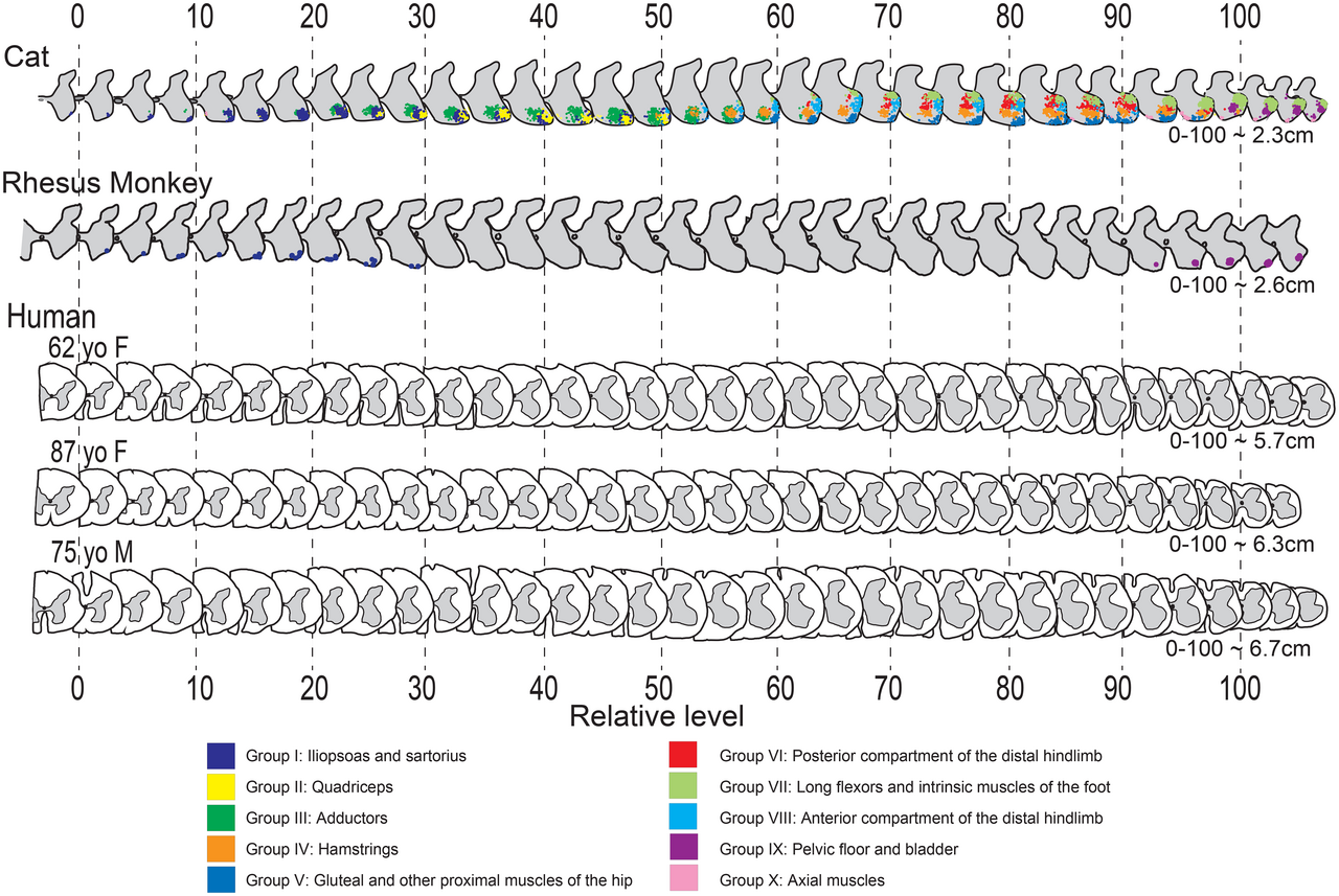 spinal-cord-leveling-image