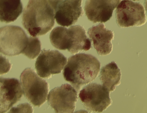 Pancreatic Organoids