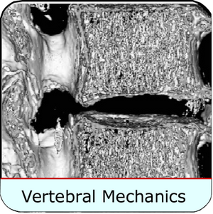 Vertebral Biomechanics
