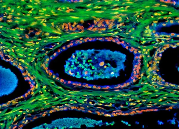 humanprostate