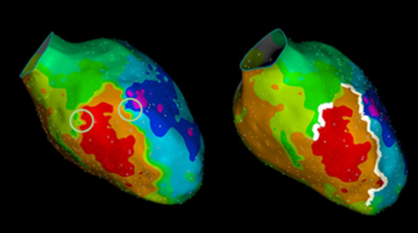 Two medical scan images with different colored highlights, one having two white circles.