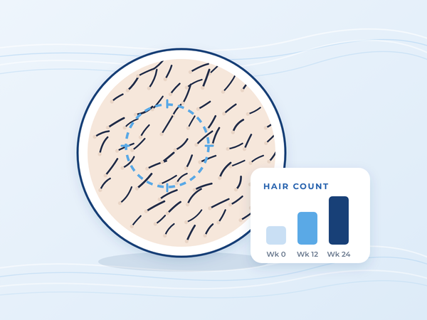 Drawing of scalp hairs under a lens next to a hair count chart