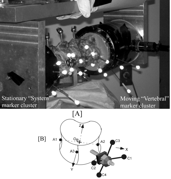 spine with optical markers
