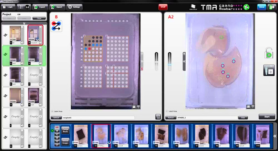 tma4