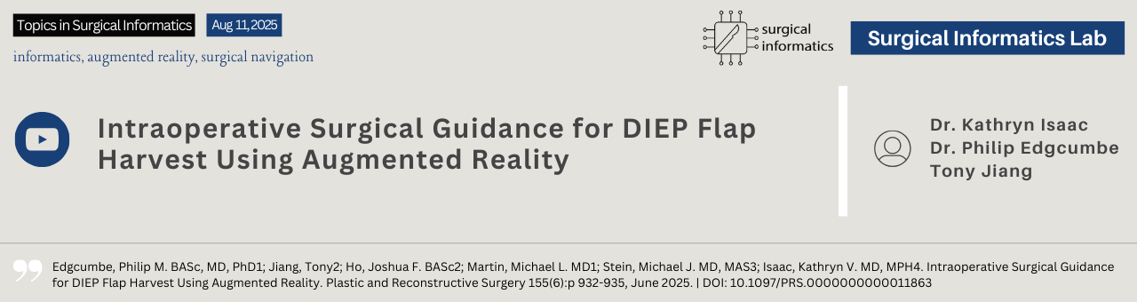 Intraoperative Surgical Guidance for DIEP Flap Harvest Using Augmented Reality