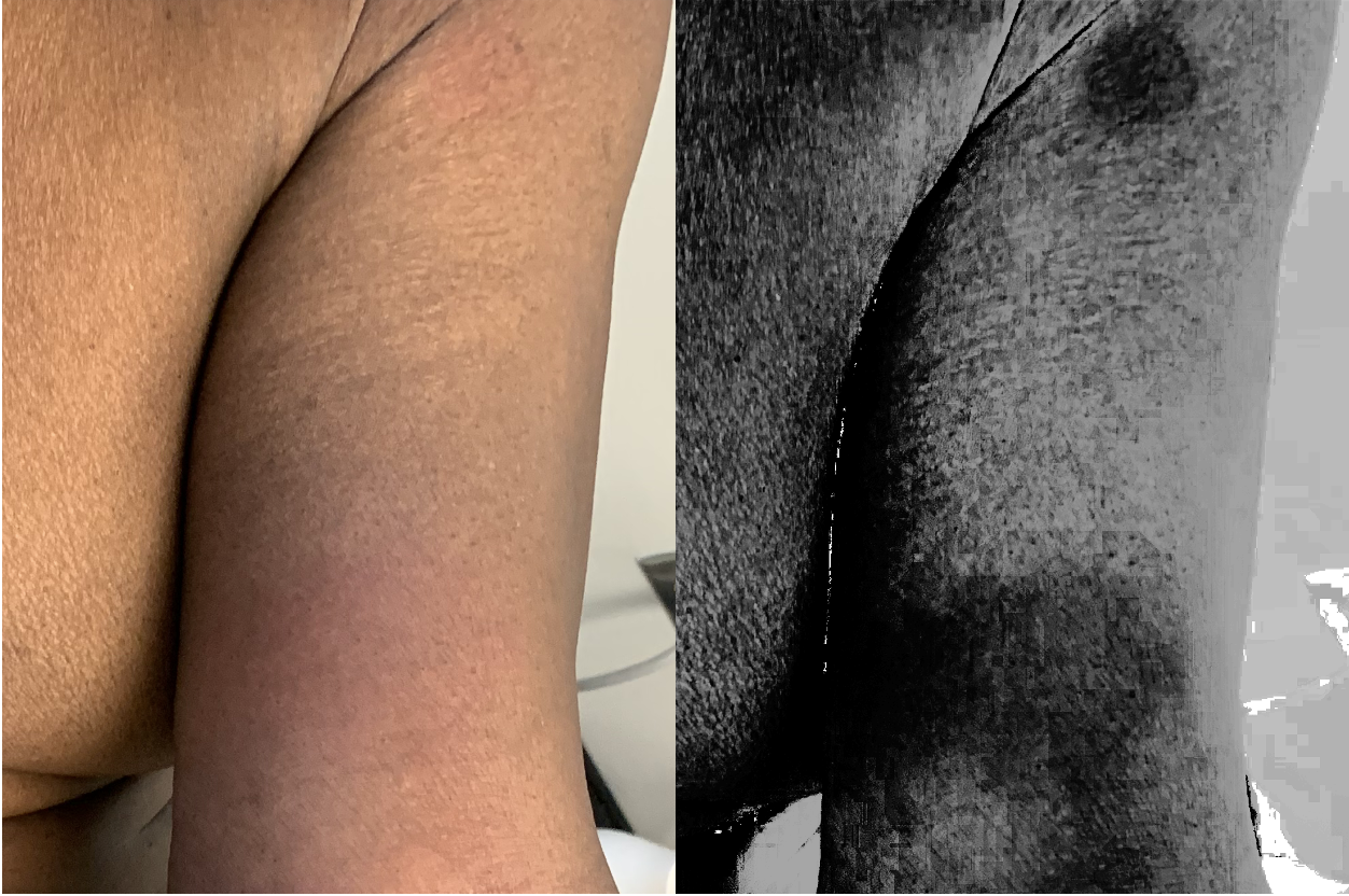 Processed and unprocessed images of skin displayed side-by-side