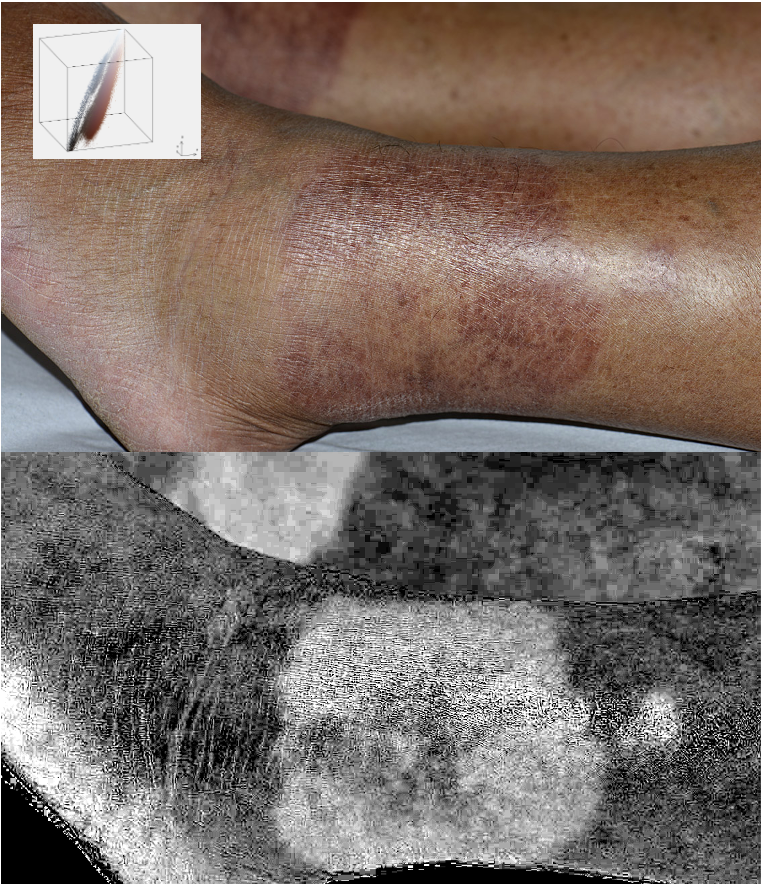 Processed and unprocessed images of skin and an RGB colorcloud